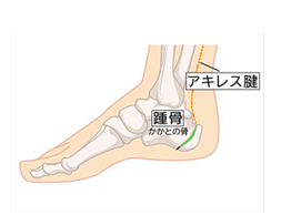 アキレス腱