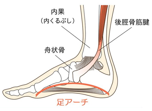 足底筋膜炎・MTP関節炎